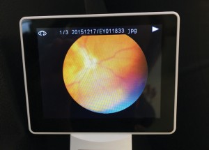I SEE YOU: The author’s fundus is a large, clear image on the screen of a digital retinal camera.