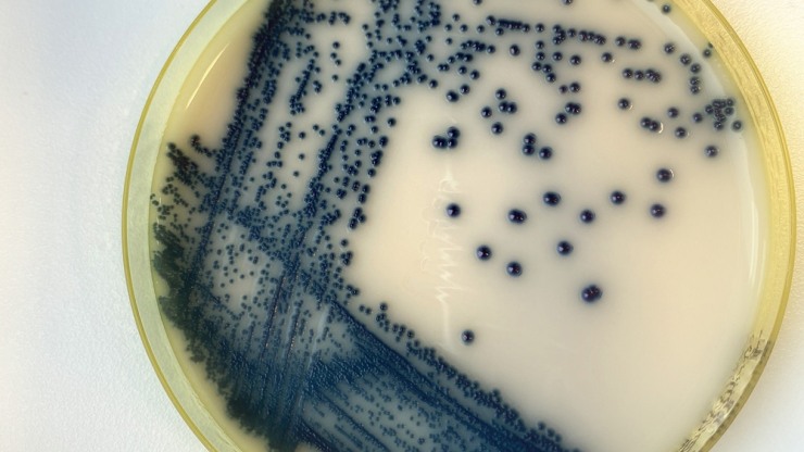 The Fungus Inside Us | Medicine@Brown | Medical School | Brown