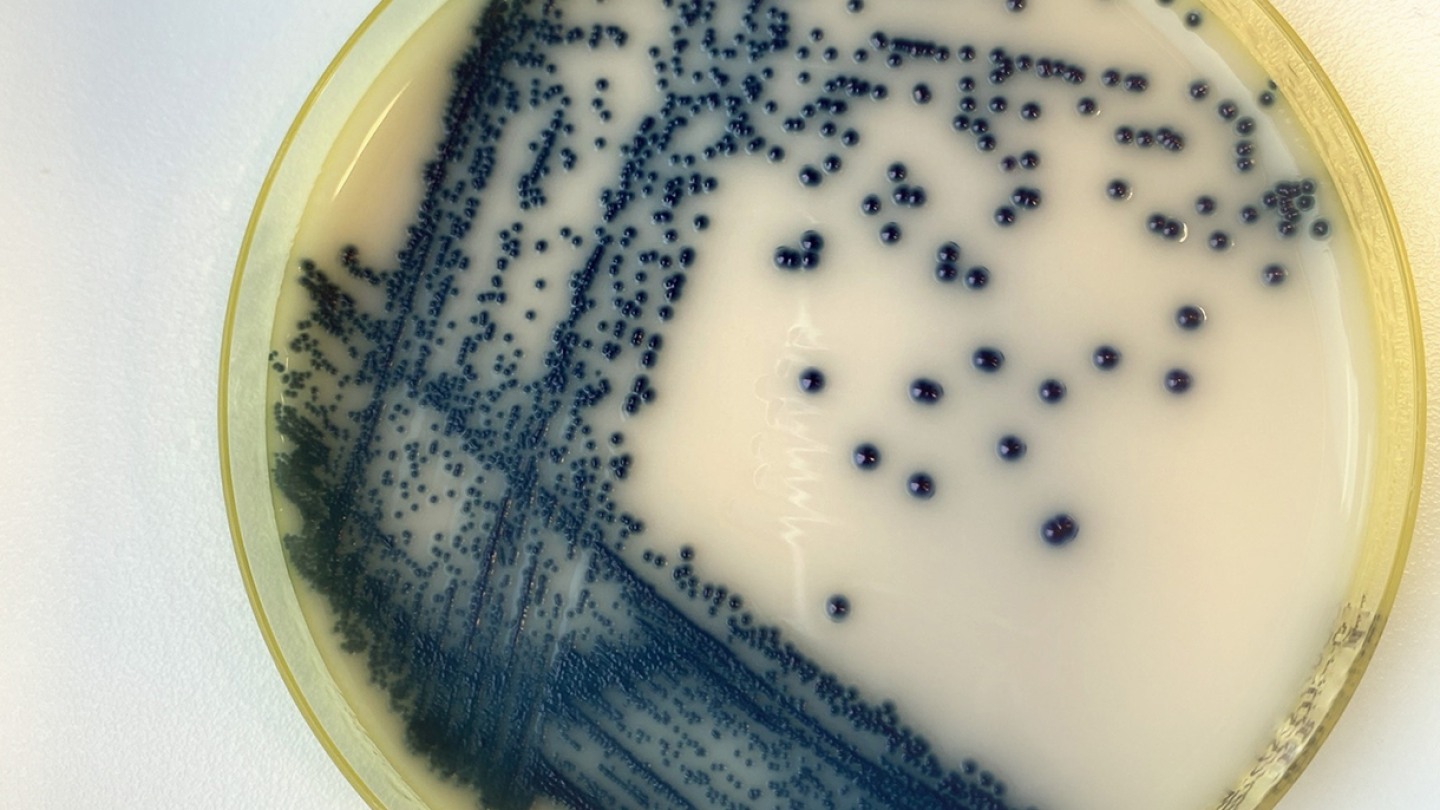 The Fungus Inside Us | Medicine@Brown | Medical School | Brown