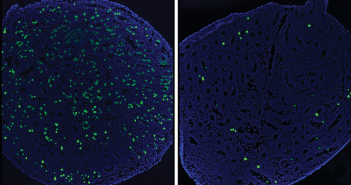 Mice lacking the gene for the protein TAF4b (right) produce fewer undifferentiated germ cells (green) than mice with the gene (left).