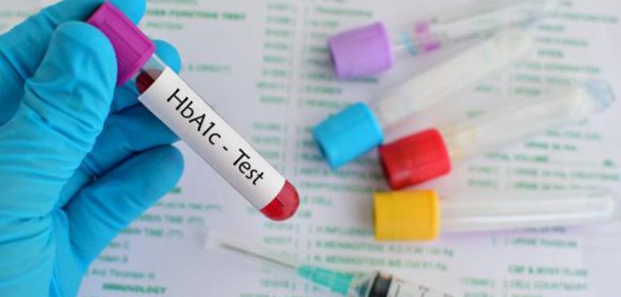 A new study in finds that HbA1c tests underreport a key blood sugar measure in African-Americans with sickle cell trait. iStock photo