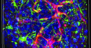 Lab's mini-brains grow blood vessels in vitro. Courtesy Hoffman-Kim lab.