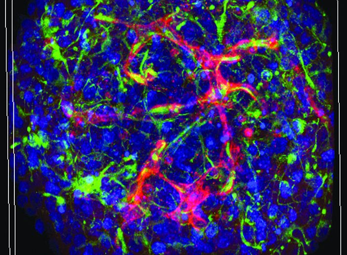 Lab's mini-brains grow blood vessels in vitro. Courtesy Hoffman-Kim lab.