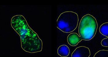 Tight clumps of green fluorescing FUS form in the untreated yeast cell on the left, but the protein remains diffuse and unclumped in the phosphorylated cell on the right. Courtesy Monahan et al.