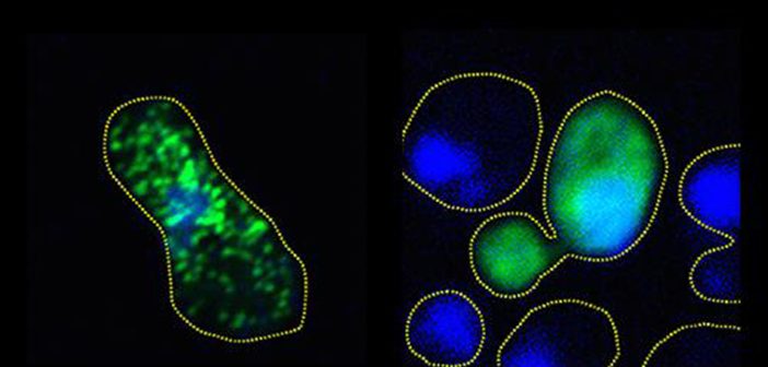 Tight clumps of green fluorescing FUS form in the untreated yeast cell on the left, but the protein remains diffuse and unclumped in the phosphorylated cell on the right. Courtesy Monahan et al.