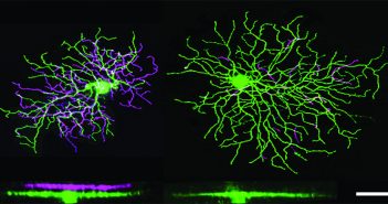 Retinal cells. Photo courtesy Berson Lab.