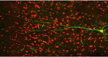 As part of her study, Judy Liu and her team looked at neurons in the somatosensory cortex in mouse models of epilepsy. Courtesy Liu et al.