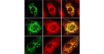 Sirt4 (in green) in mitochondria (in red) of cells, with superimposed image on right (overlap in yellow). Courtesy Jason Wood