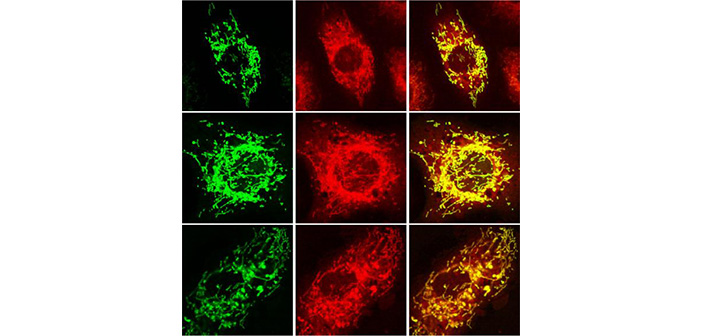 Sirt4 (in green) in mitochondria (in red) of cells, with superimposed image on right (overlap in yellow). Courtesy Jason Wood