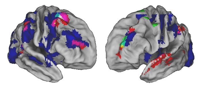 The areas of the brain that are active in three separate experiments (colored red, blue, and green) as you monitor or perform a complex sequence, like making a cup of coffee. There is significant overlap (pink, cyan, yellow, and white) in the very front of the brain indicating the region’s importance. Courtesy Desrochers Lab