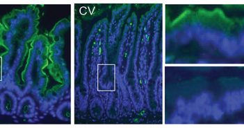 The amount of vitamin A-converting protein, shown in green, varies between the guts of normal mice (CV) and mice without gut bacteria (GF). Image courtesy Vaishnava Lab/Immunity