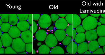Two weeks of treatment with Lamivudine reduced the signs of chronic inflammation—white blood cells stained pink amongst green fat cells—in old mouse fat tissue. Image courtesy Sedivy Lab