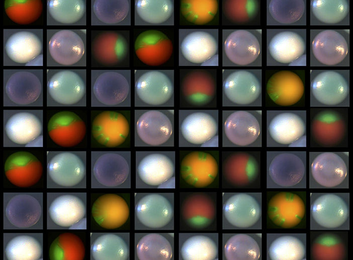 The white, turquoise, lavender, and purple colonies are from C. albicans strains grown on a special kind of agar. The orange/green pictures show colonies with fluorescent reporters connected to the genetic hotspot. Image courtesy Bennett Lab