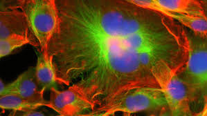 Polyploidal giant cancer cells